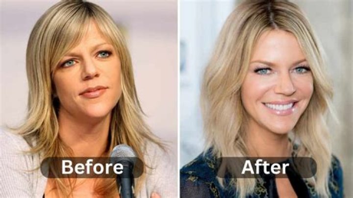 Kaitlin Olson’s Plastic Surgery, Net Worth, Husband, Appearance