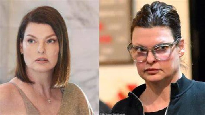 
Linda Evangelista’s Plastic Surgery Nightmare: Her Before And After Photos Explored 