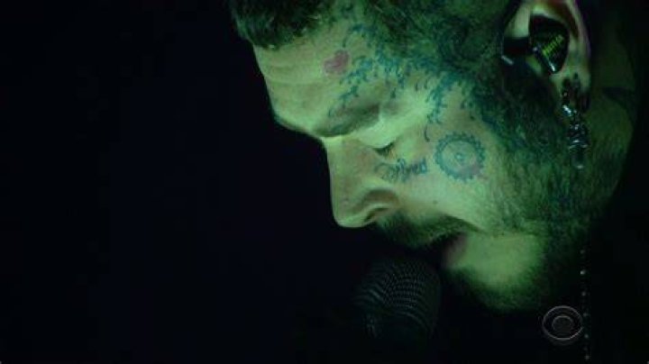 
Post Malone Gives Update After Suffering Dramatic Fall Onstage 